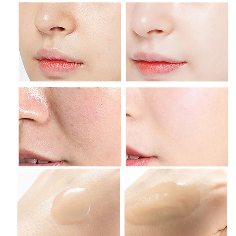 Peeling Serum Salicylic Acid F - Niacinamide Pore Shrinking Essence review and price
